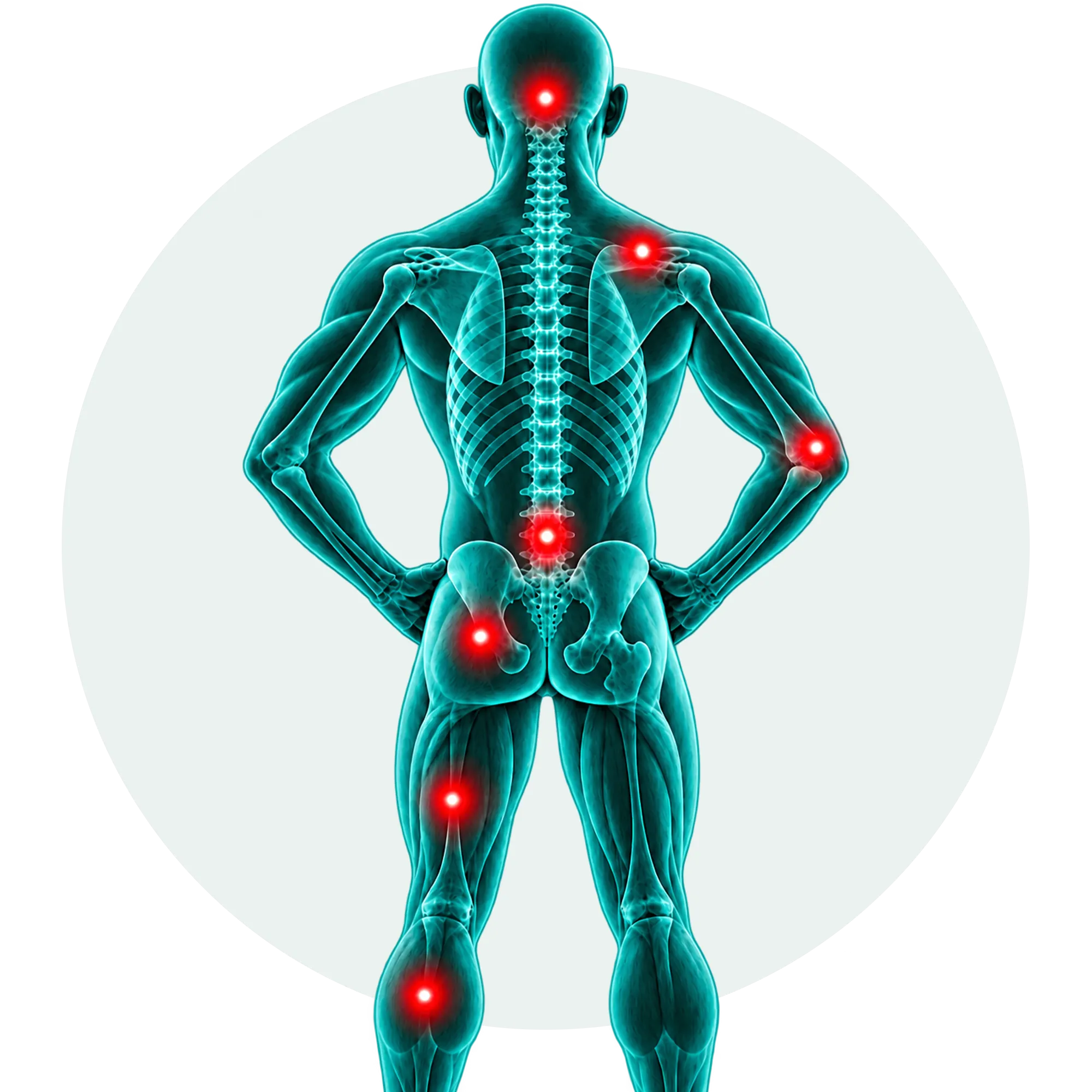 Interactive dry needling treatment areas